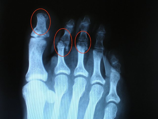 Radiografia